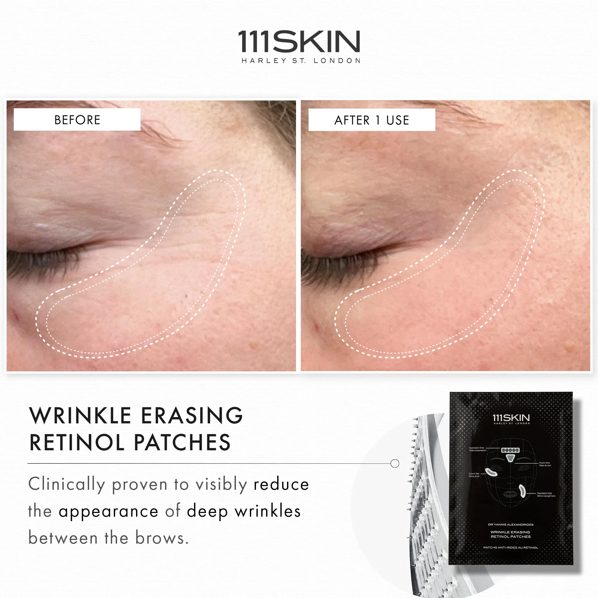 Wrinkle Erasing Retinol Patches - Image 2