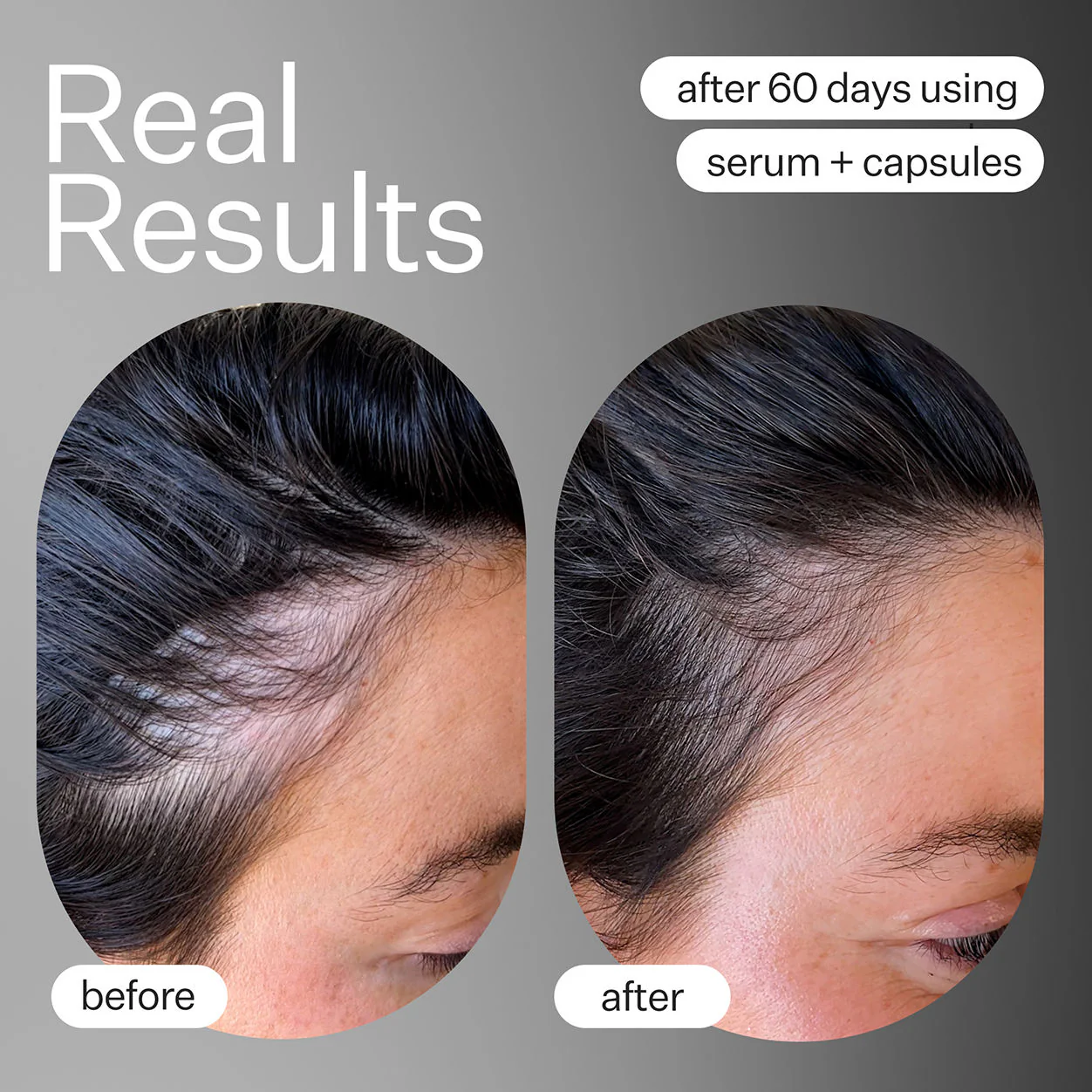Advanced Fuller Hair System - Image 5