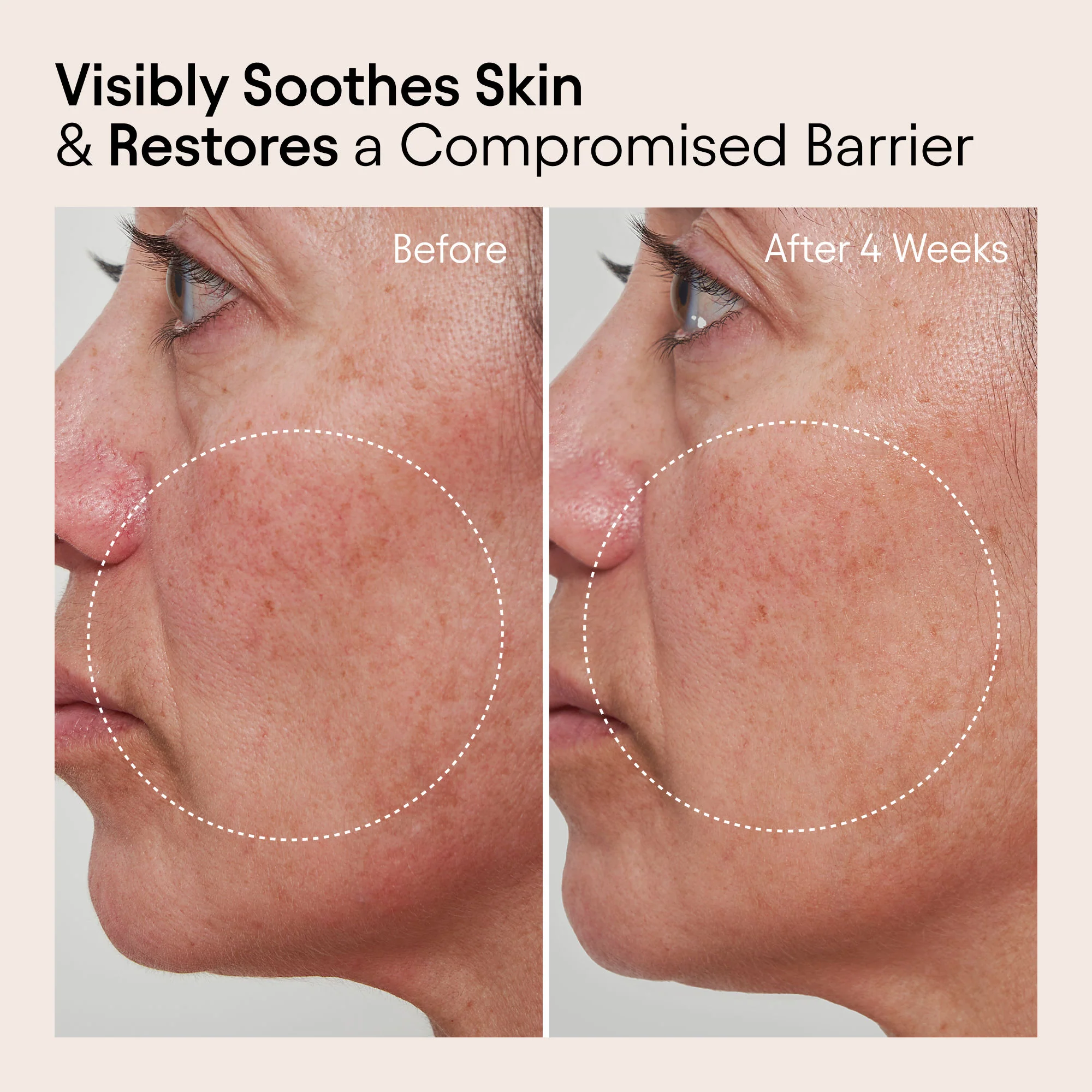 Barrier Repair Cream Moisturizer for Eczema, Wrinkle and Barrier Repair - Image 4