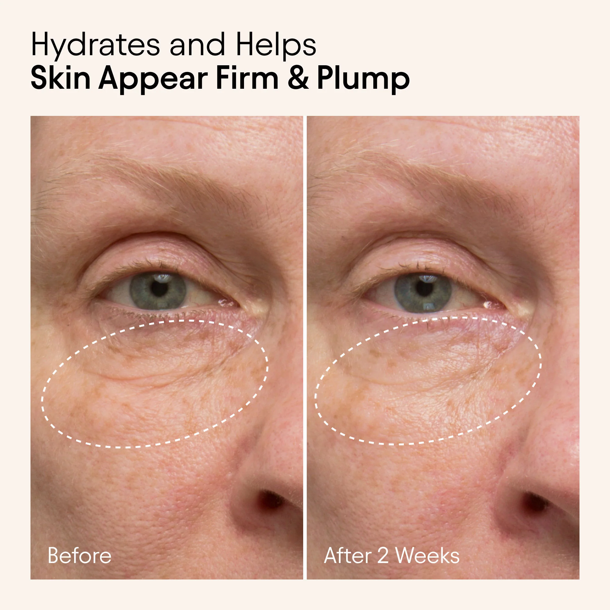 Hydrating Firming Serum with Niacinamide and Nettle - Image 3