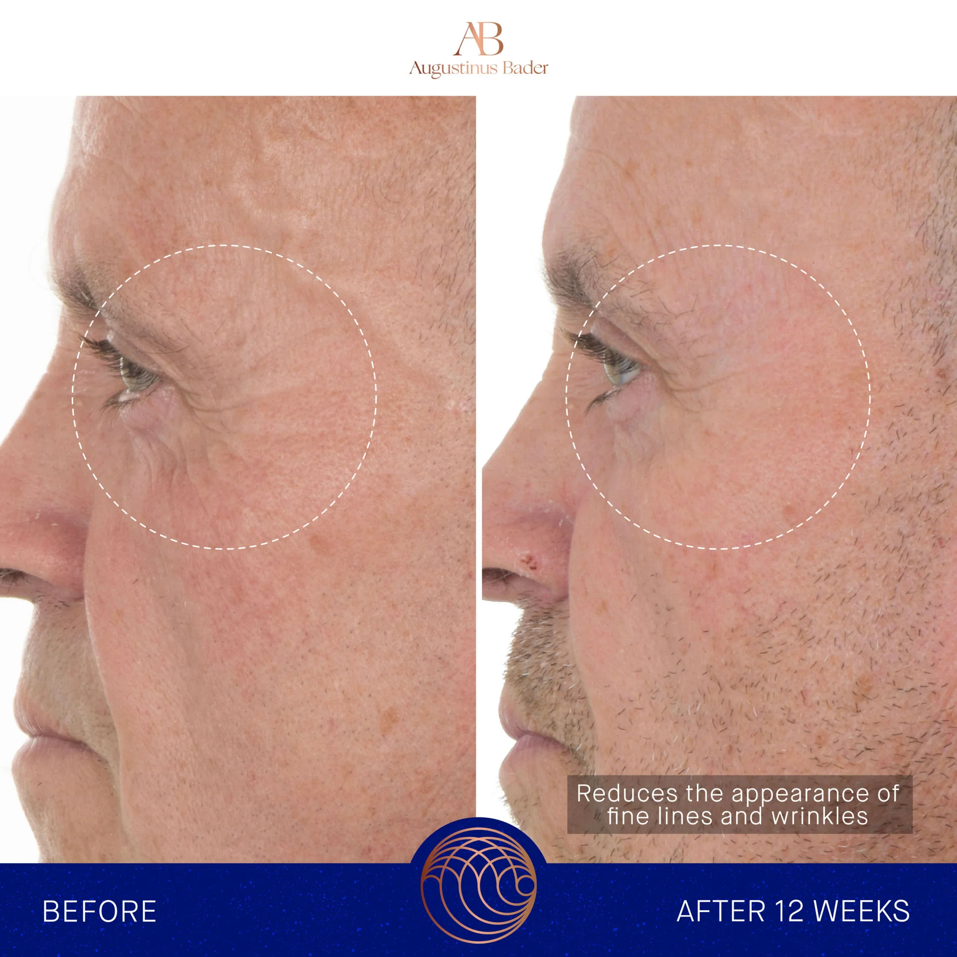 The Retinol Serum - Image 2