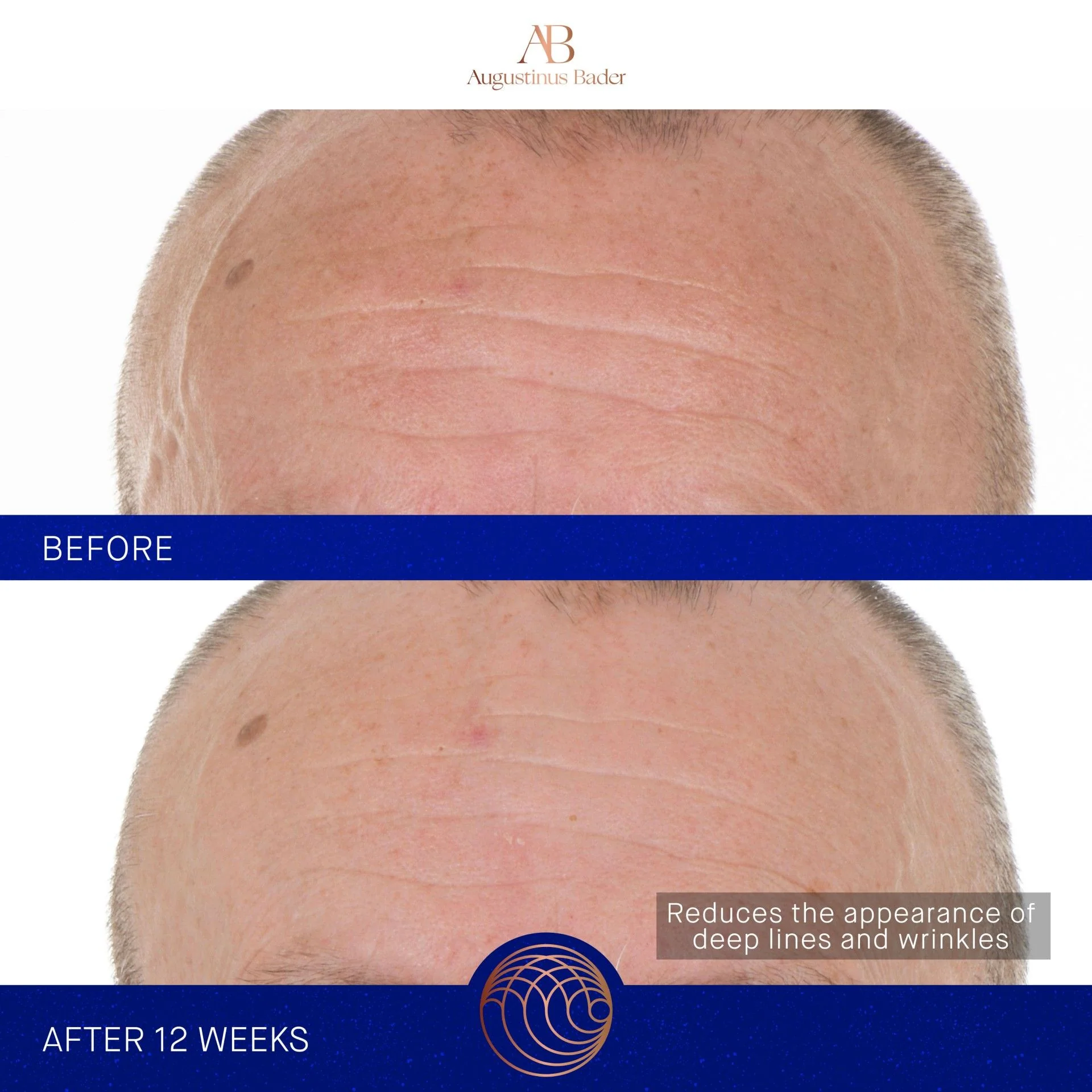 The Retinol Serum - Image 7