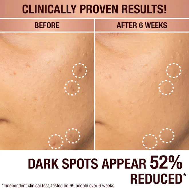 Dark Spot Correcting Radiance Recovery Serum - Image 7