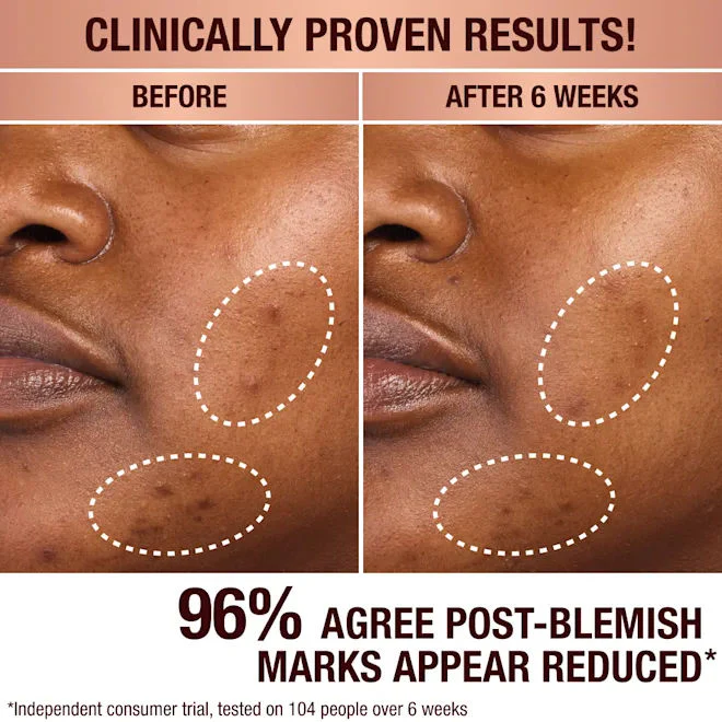 Dark Spot Correcting Radiance Recovery Serum - Image 8