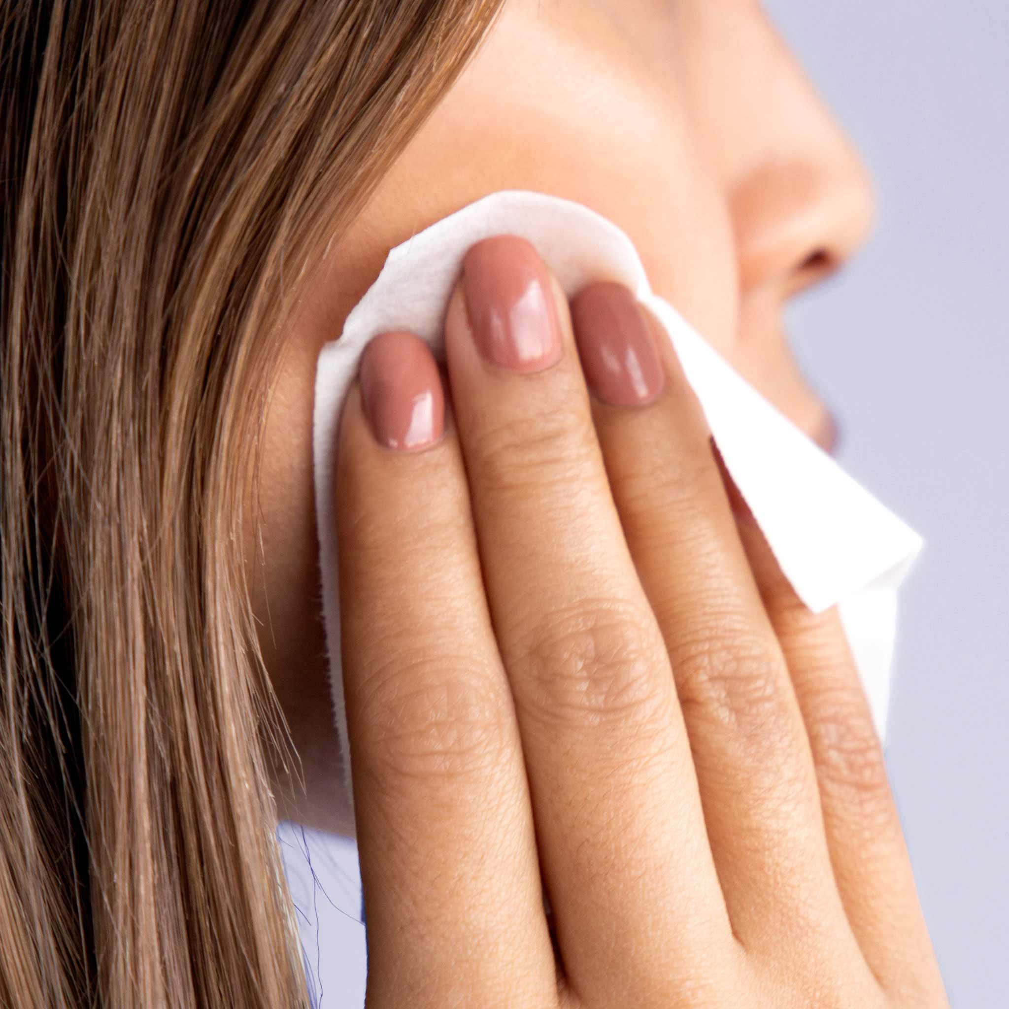 Perfect Peel - 10 Treatments - Image 6