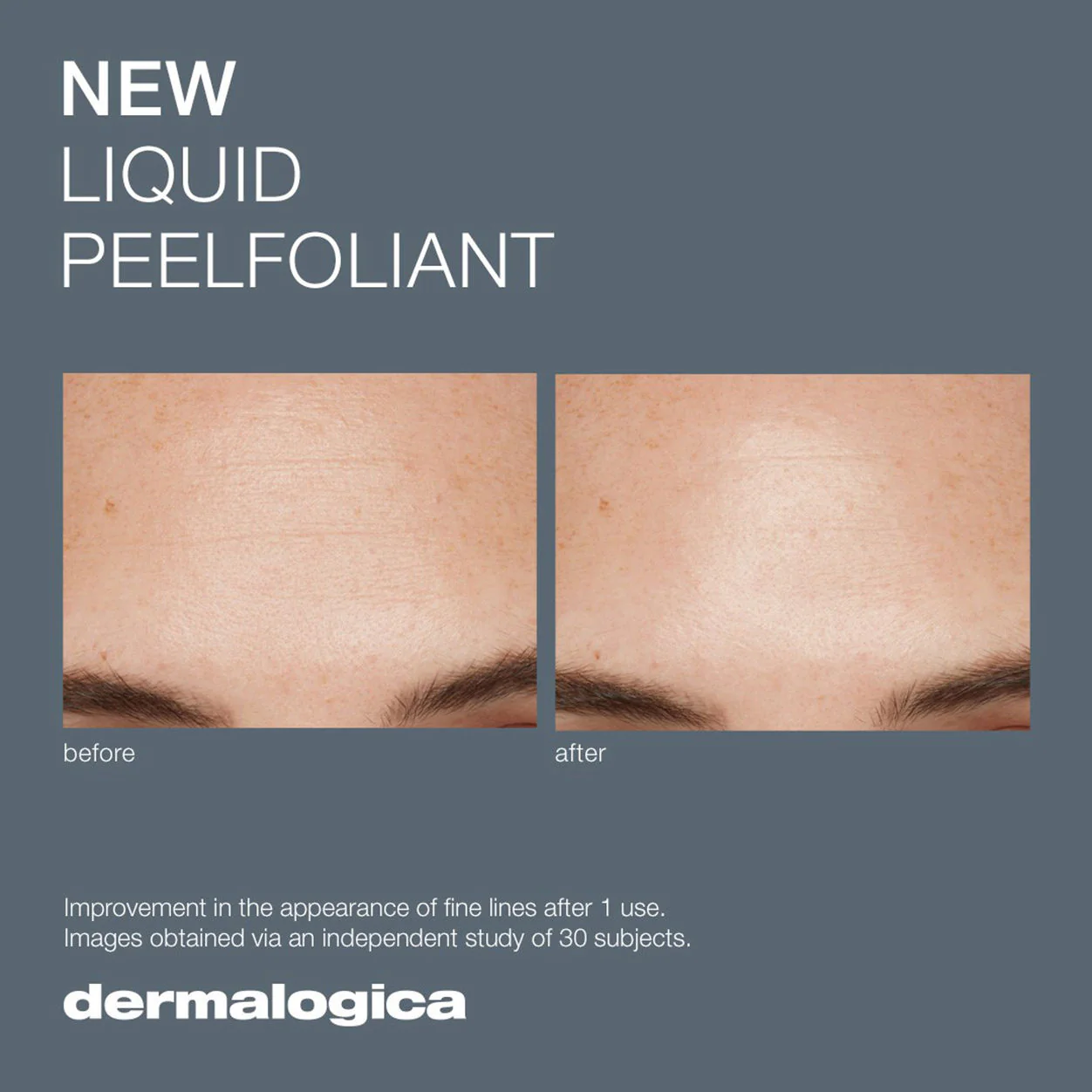 Liquid Peelfoliant - Image 5