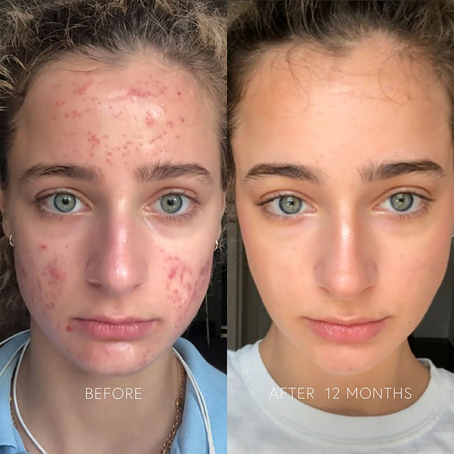 Clarifying Face Cream - Image 5