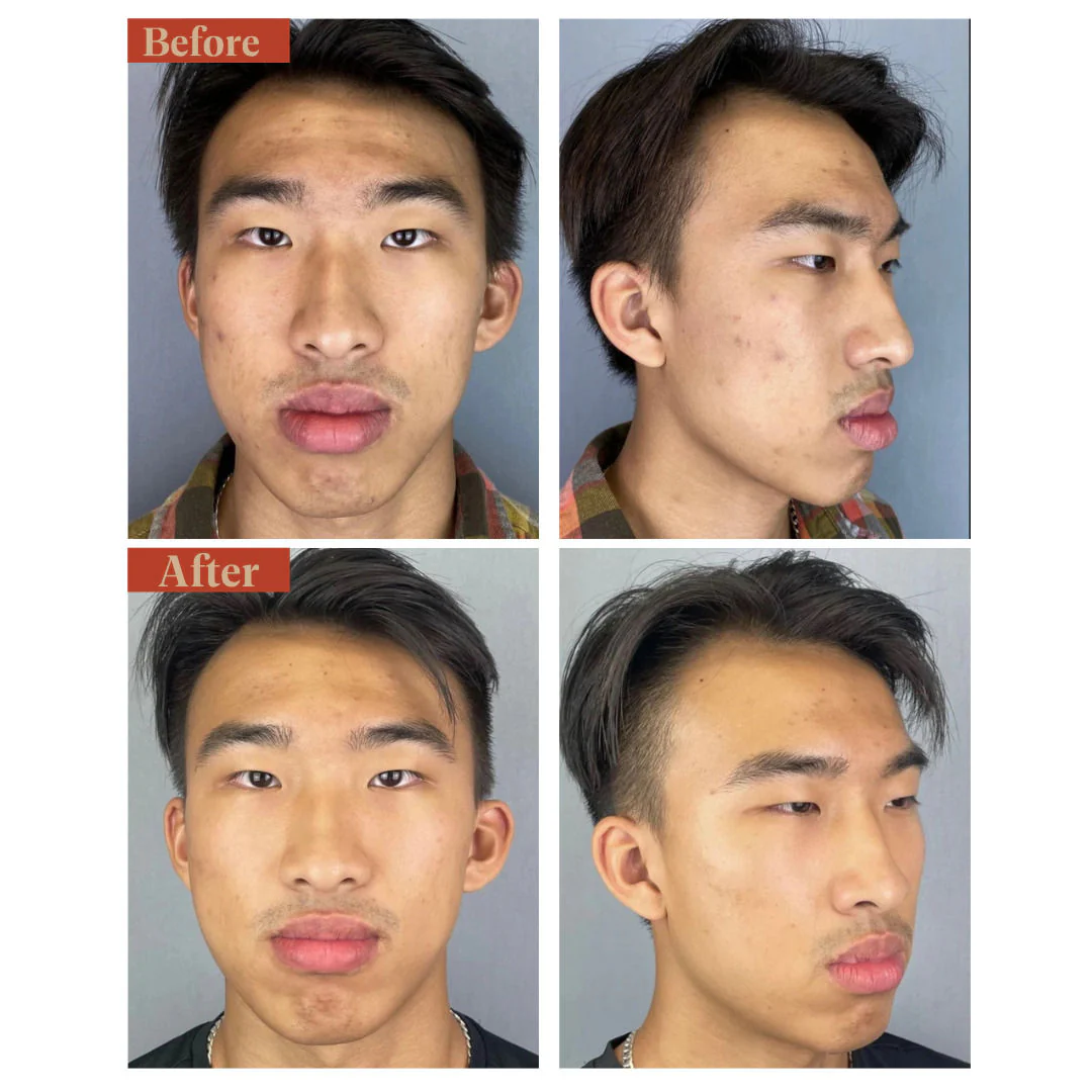 Clean Retinol - Image 3