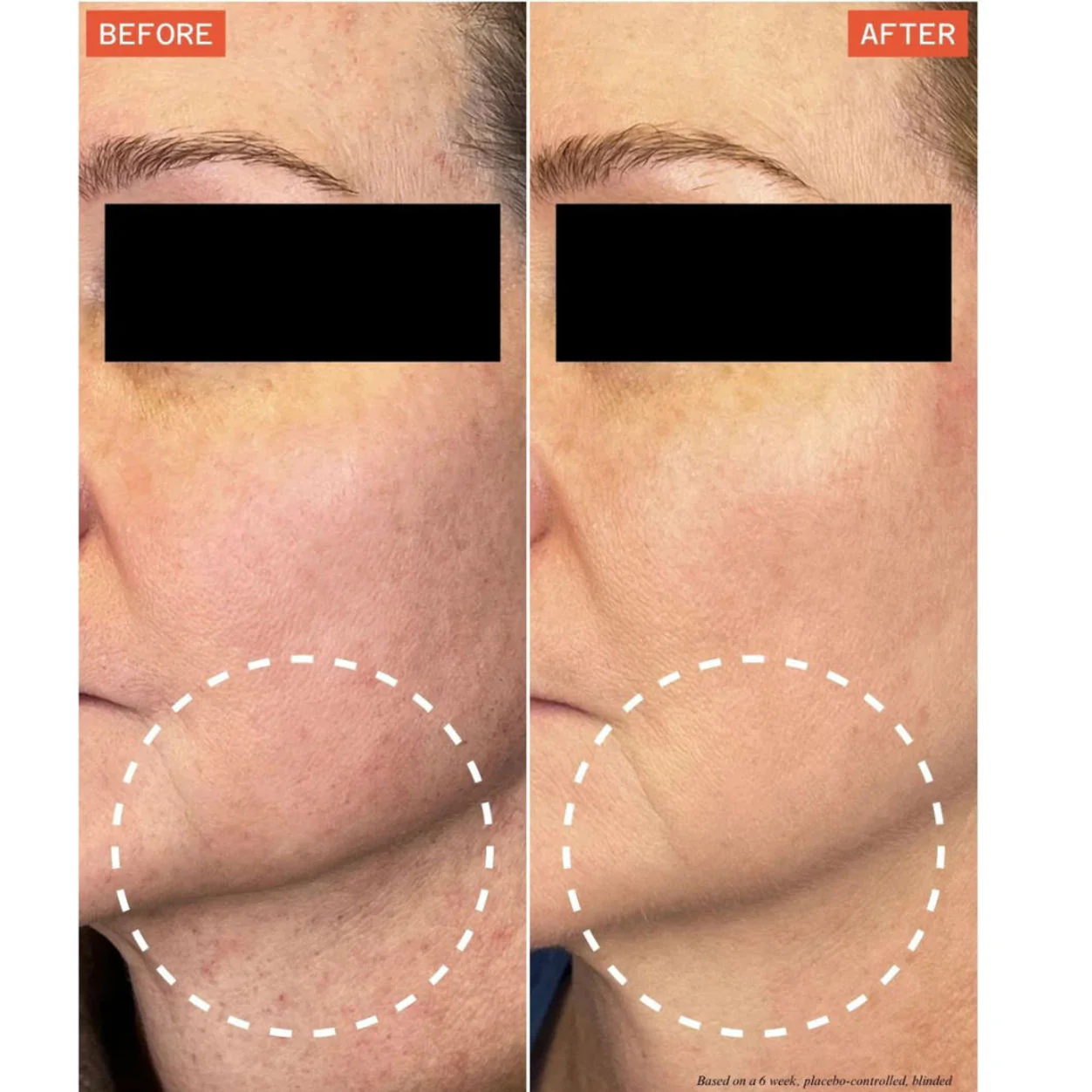DermaReverse - Image 3