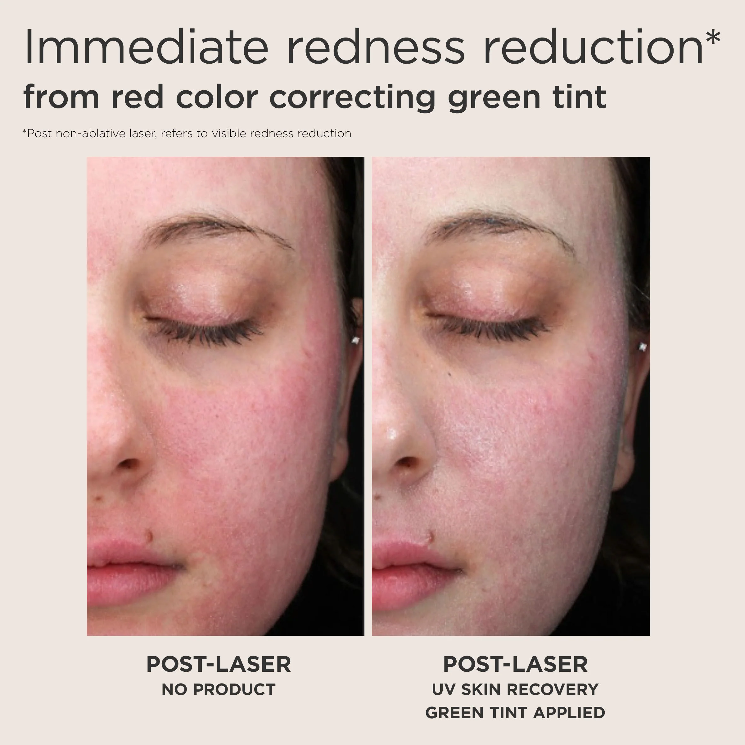UV Skin Recovery Red Color Correcting Green Tint Broad Spectrum SPF 50 - Image 2