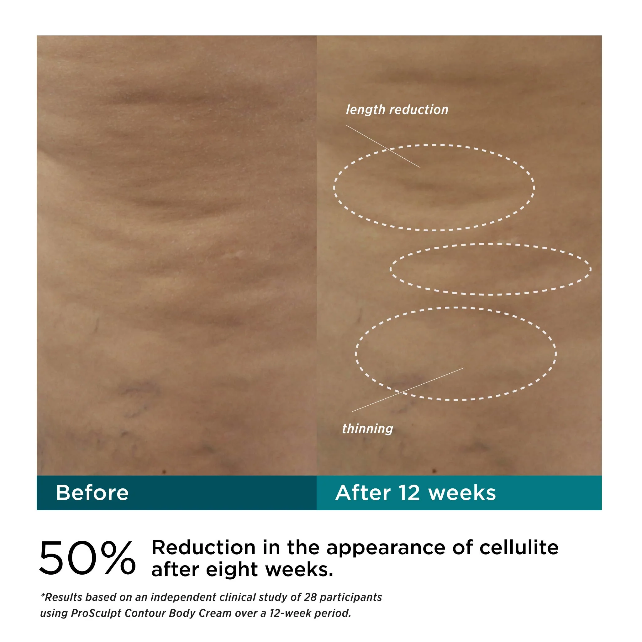 ProSculpt Contour Body Cream with AFT3™ - Image 5