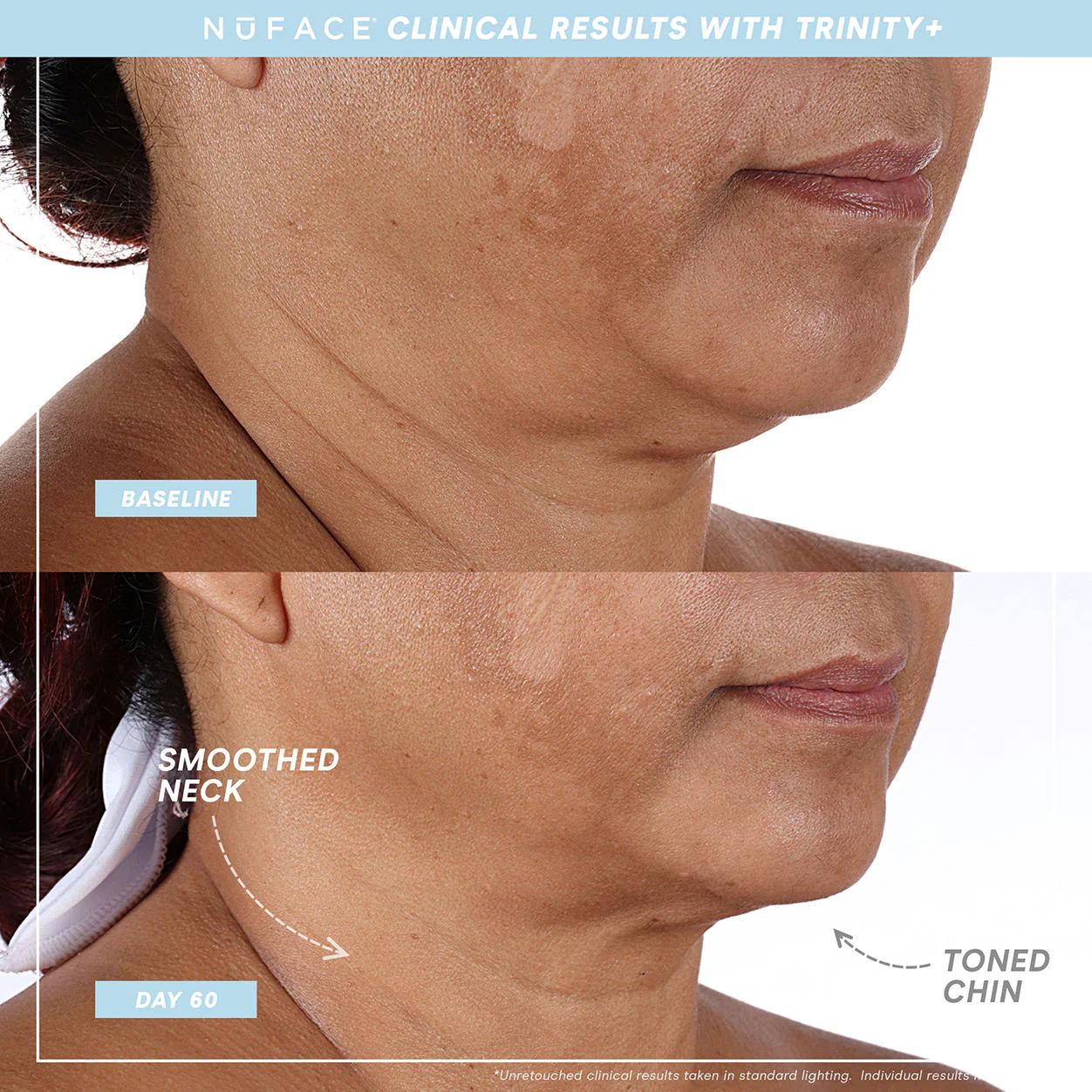 Trinity+ and Effective Lip and Eye Attachment - Image 3
