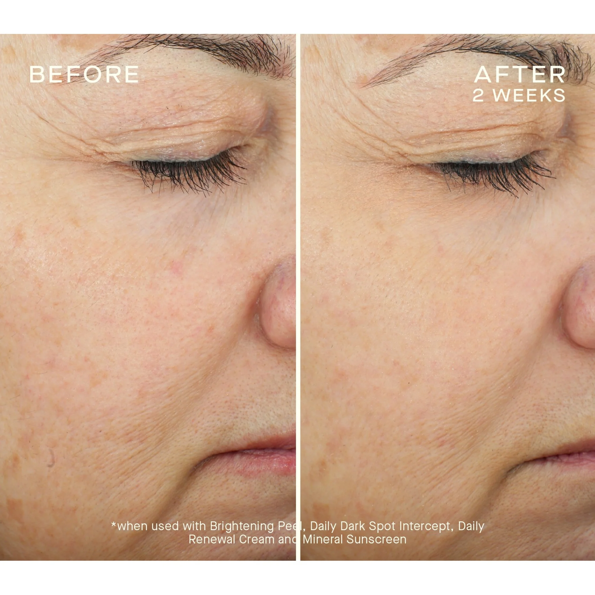 Brightening Peel Kit - Image 3