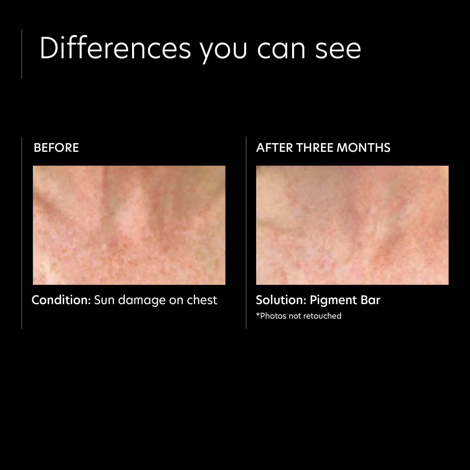 Pigment Bar - Image 3
