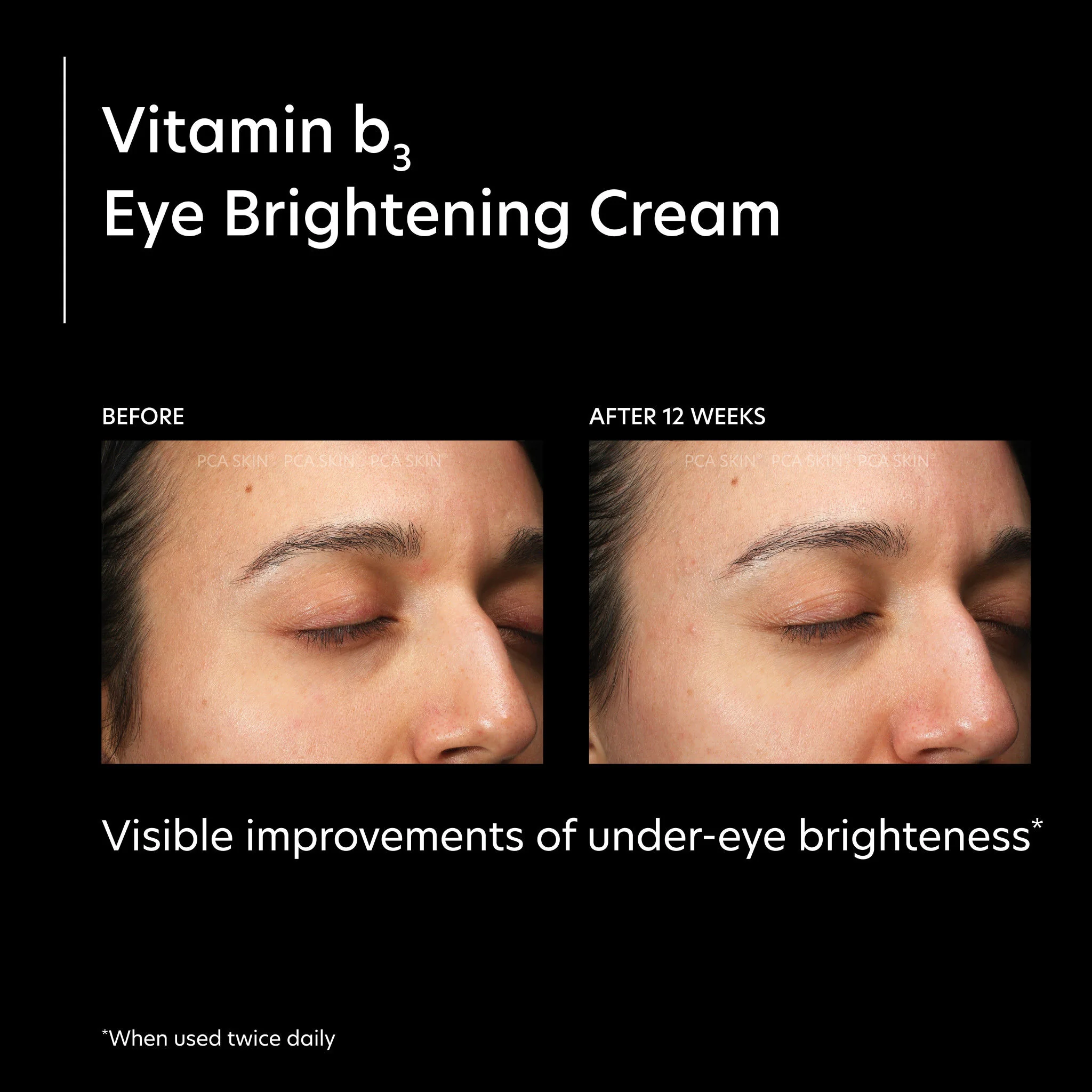 Vitamin B3 Eye Brightening Cream - Image 2