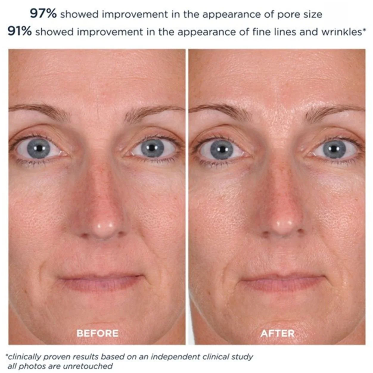 PowerGlow Peel - Image 4