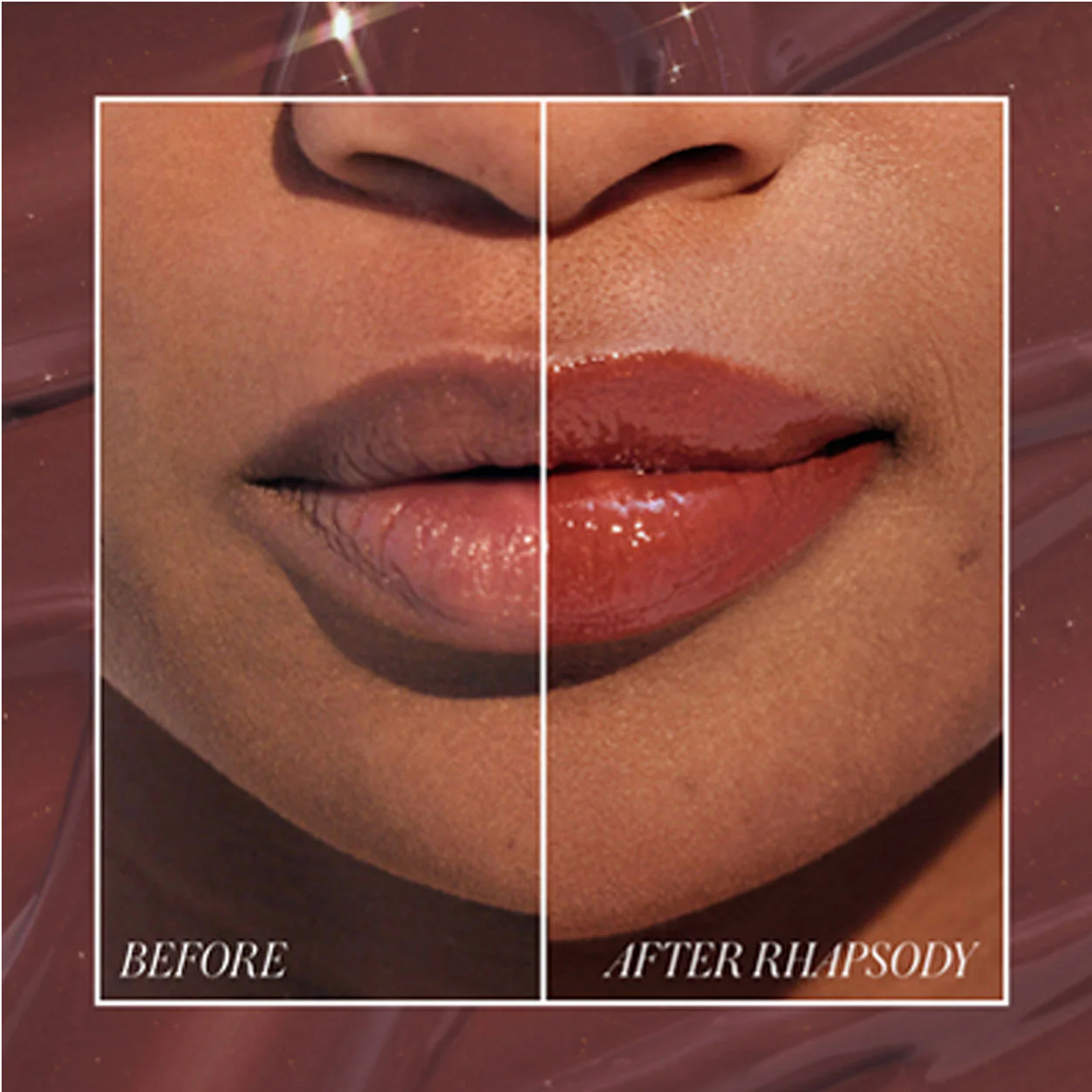 Liplights - Image 22