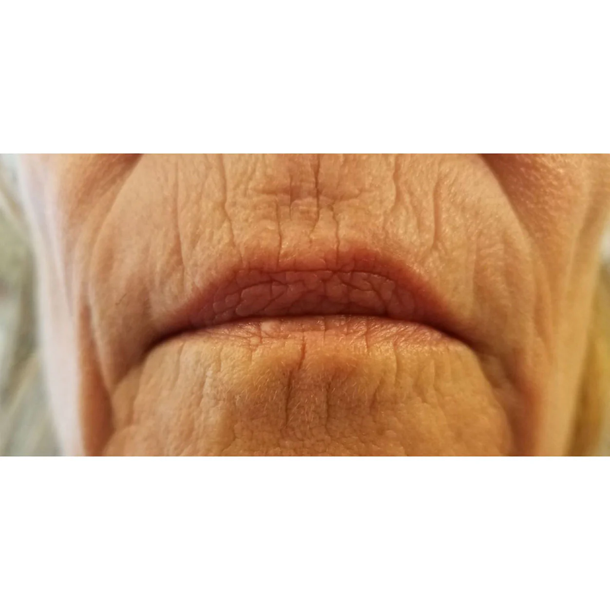 Super Liplift 2-Pack - Image 3