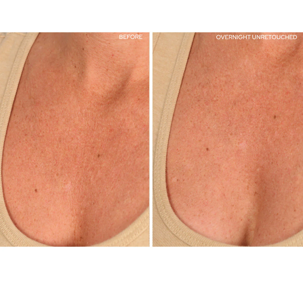 ChestLift - Image 7