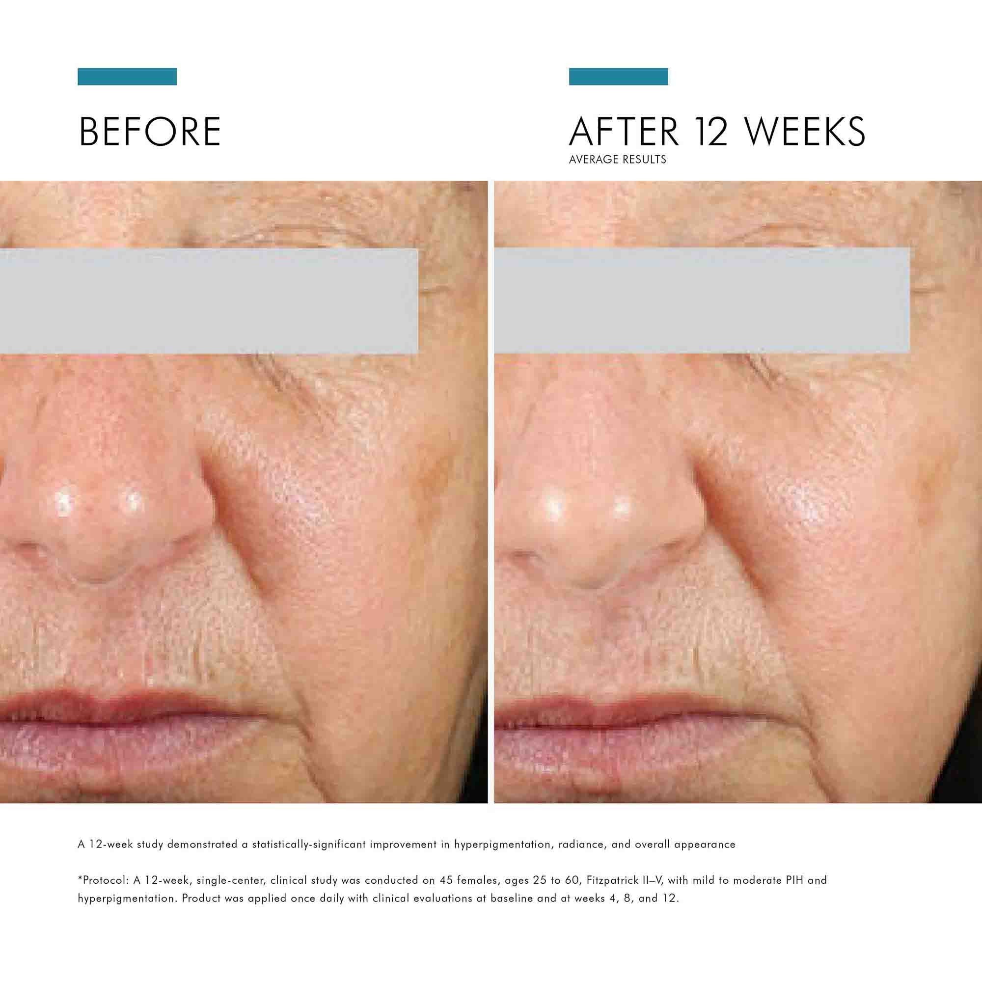 Daily Brightening UV Defense SPF 30 - Image 3