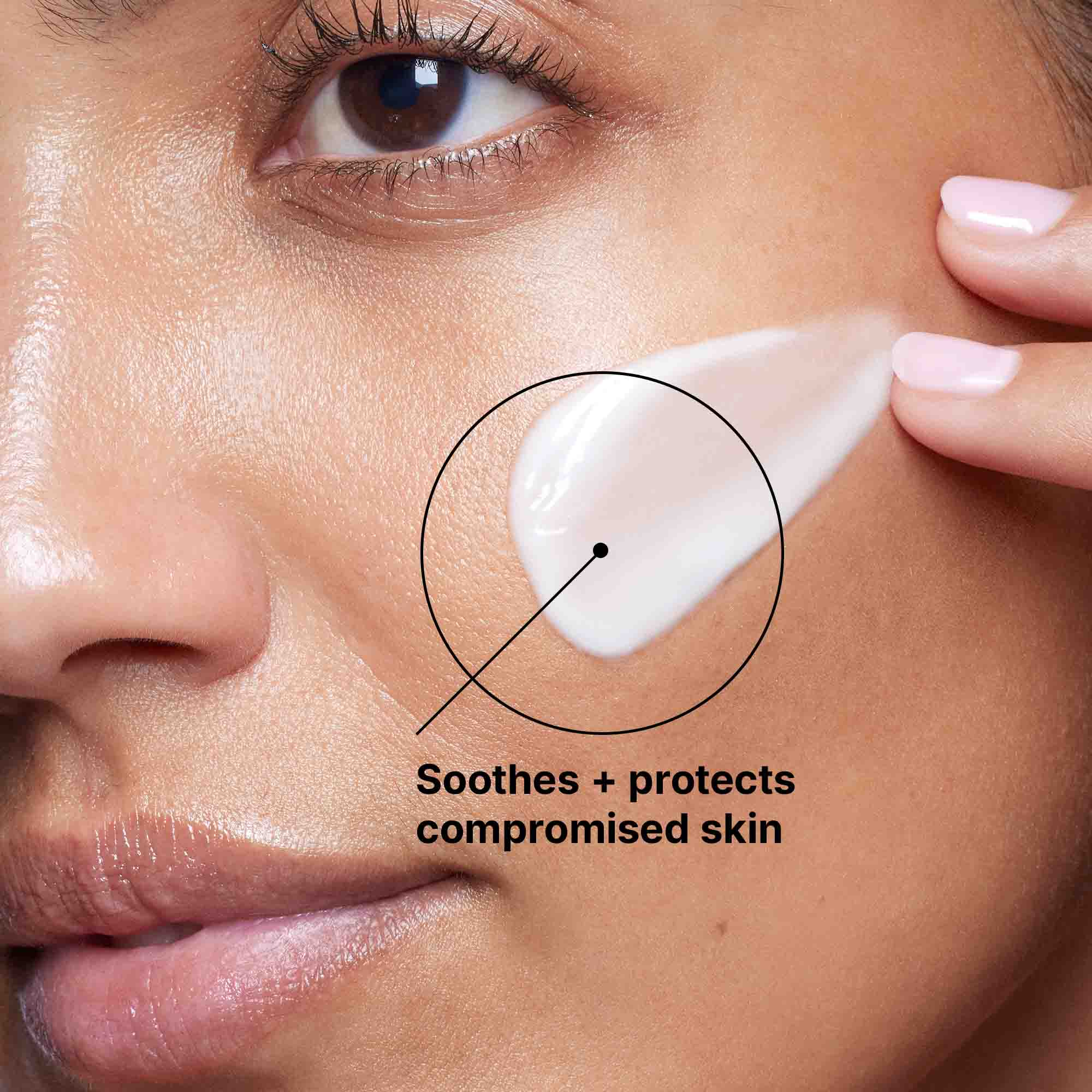Epidermal Repair - Image 5