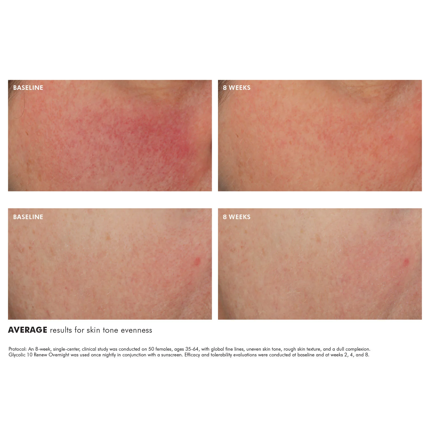 Glycolic 10 Renew Overnight - Image 3