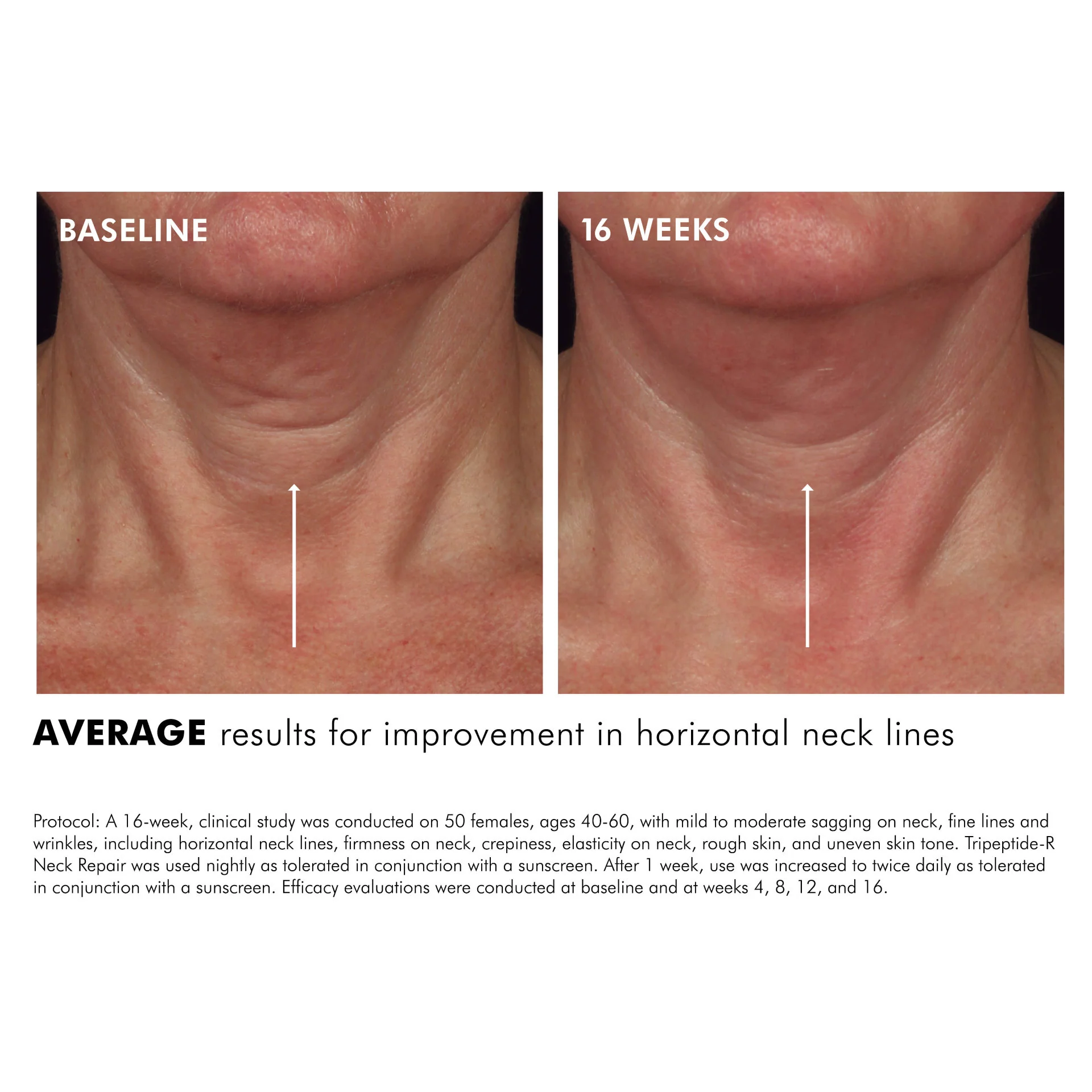 Tripeptide-R Neck Repair - Image 5