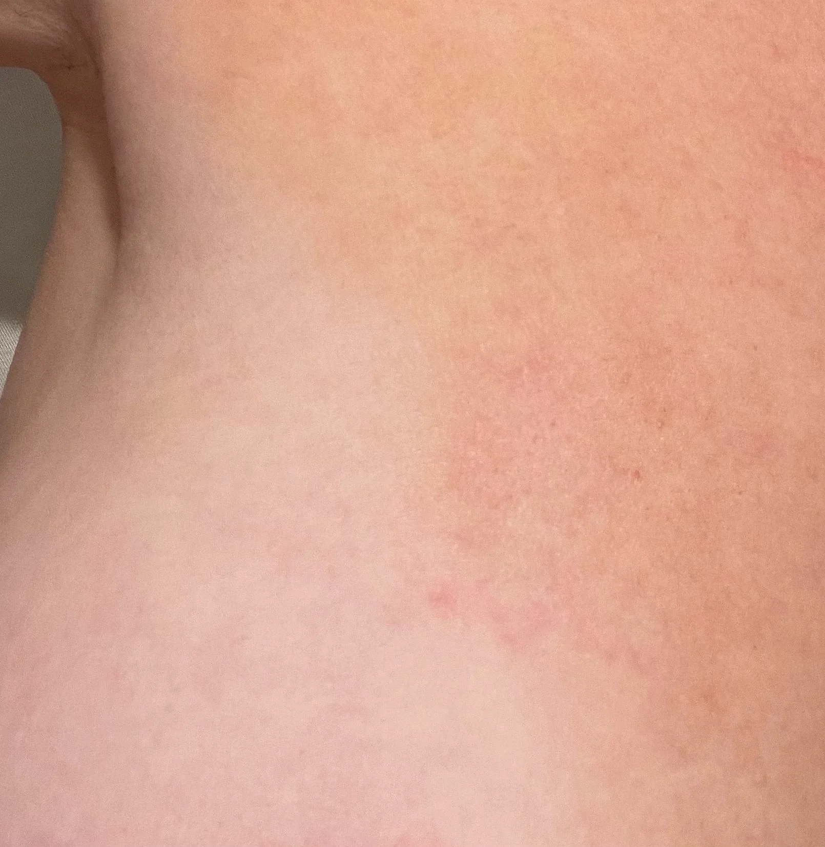 Scar Concentrate - Image 4