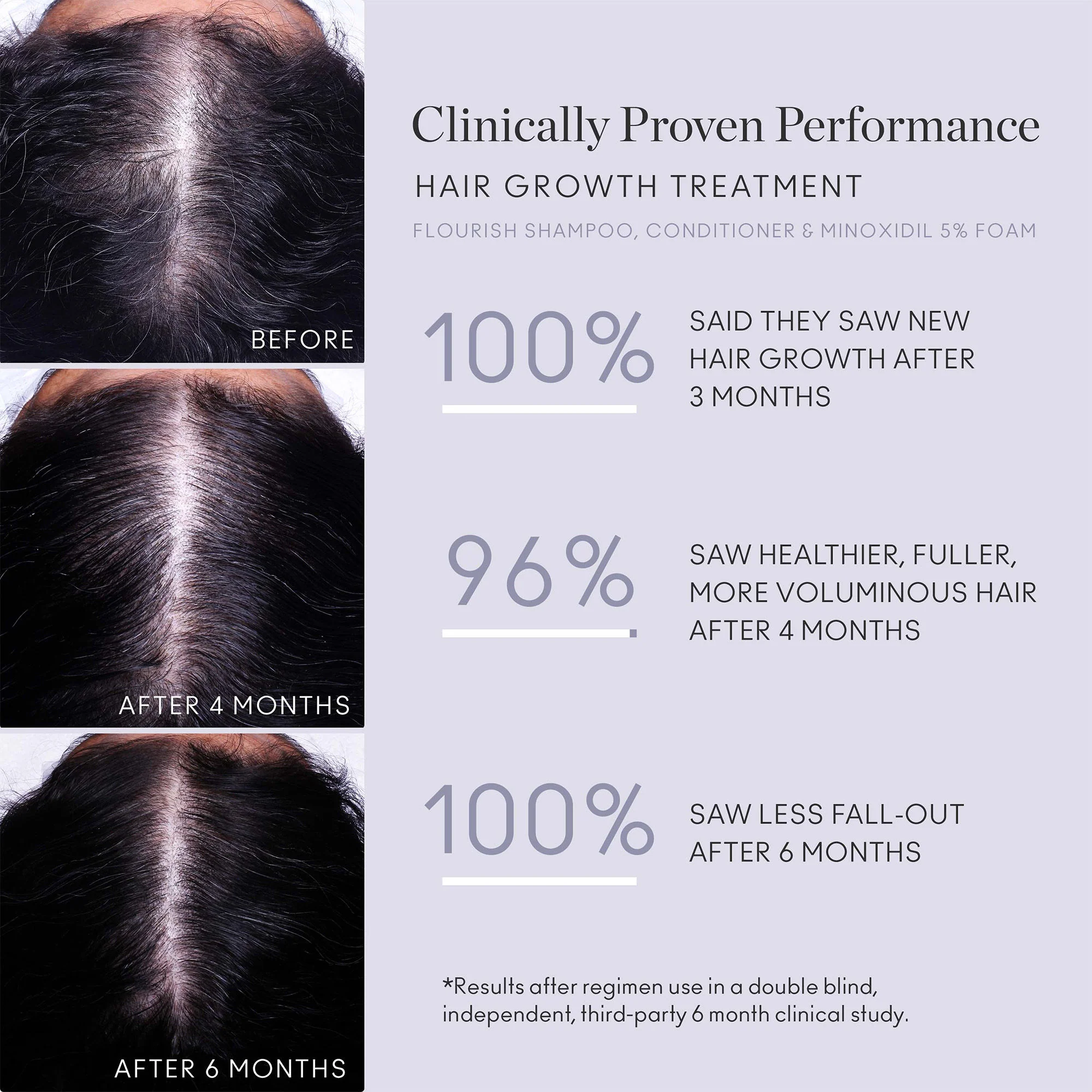 Flourish Nightly Intensive Hair Growth Treatment 90 Day - Image 4