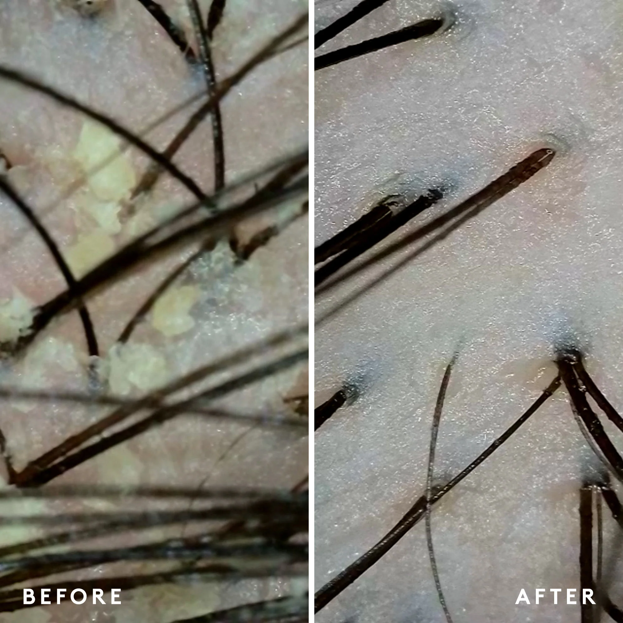 Scalp Remedy Conditioner for Scalp and Hair Health - Image 6